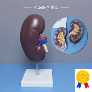 人体肾脏解剖模型肾器官剖u面内脏结构放大泌尿系统医学生教学模