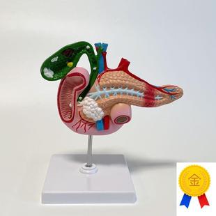 康泰模型胆囊十二指肠胰腺消化道医药H促销病理内分泌胆管石块阻