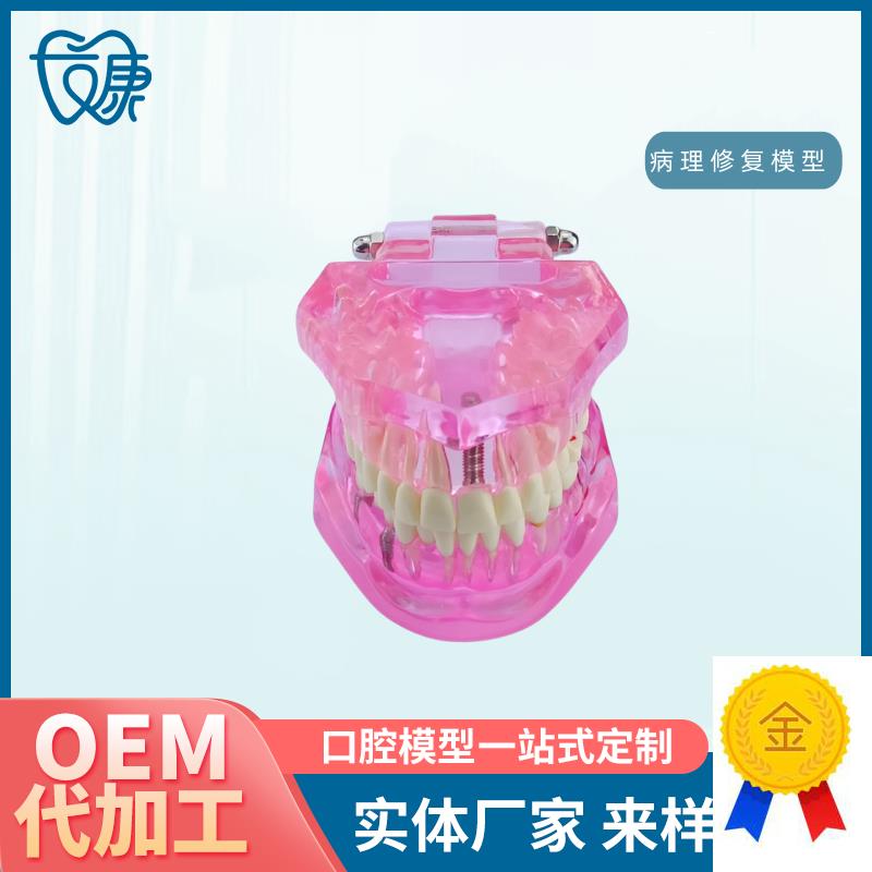 牙齿模型病理修复可拆卸正畸口腔病理牙模型S牙科医患活动沟通