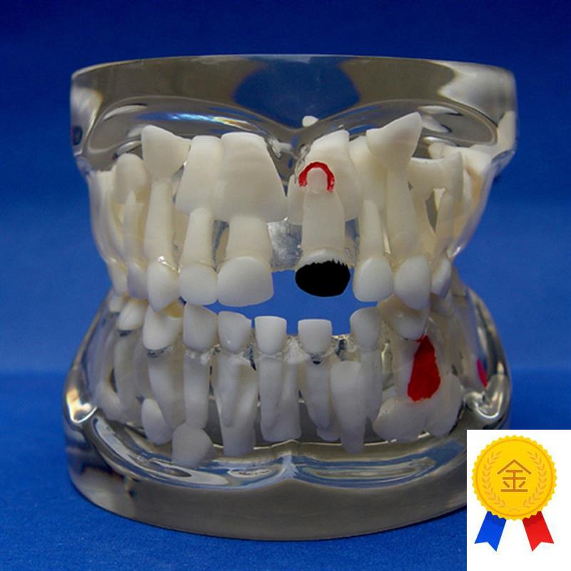 ENOVO颐诺g儿童乳牙早期病态牙列模型牙齿发育幼儿牙齿护理教学具