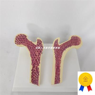 人体股骨头解剖模型骨质疏松切面解剖人类骨O骼骨架解剖医讲解教