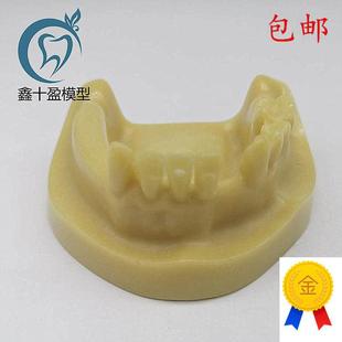 牙科材料下半口种植练习模型发泡缺失种J植练习教学模型M2028