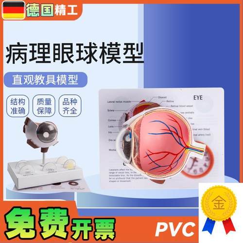 德国】病理眼g球模型眼球模型角膜病变眼球模型医学教学教材模