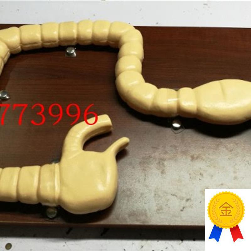 乙状结肠镜检k查模型肠病变模型大肠肠道病变模型