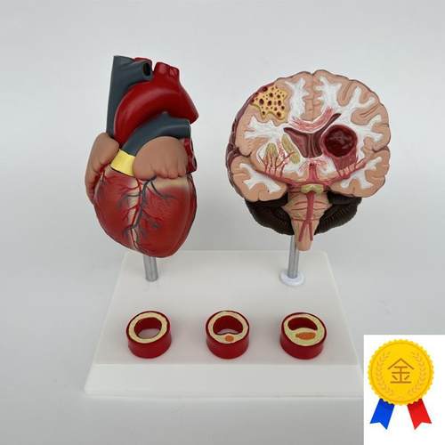 人体心脑a血管展示模型血压高心脏模具与心血管模型对比教具模型