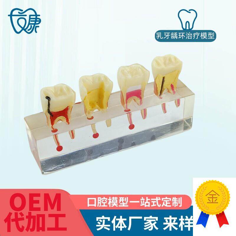 根管牙髓治疗模型牙科口腔教学牙模种F植修复病理模型医患沟通模