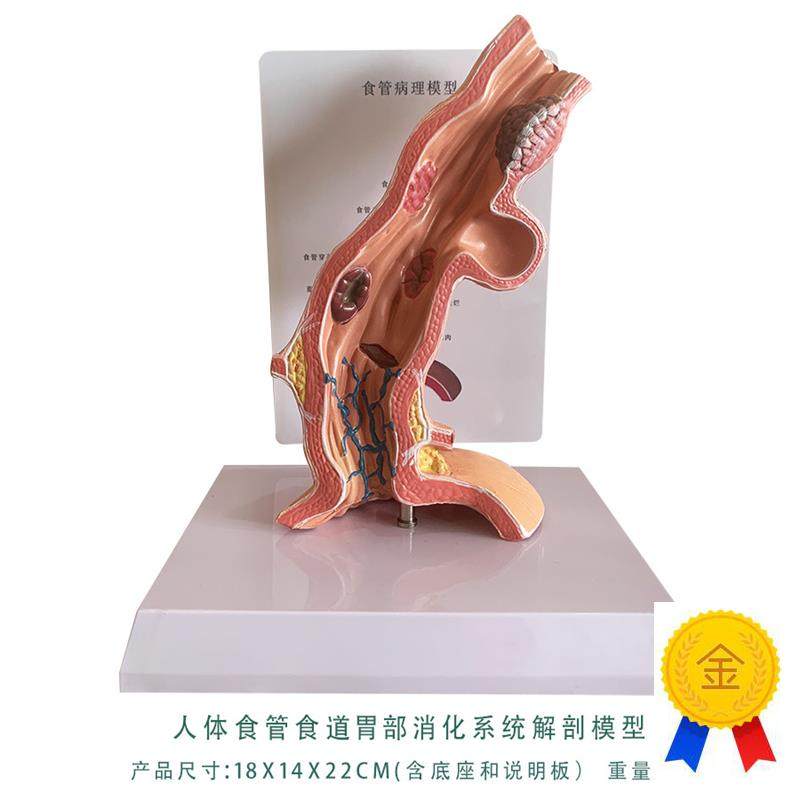 人体食管食道胃部消化系统解剖模型教学内脏解剖S人体教具厂家直