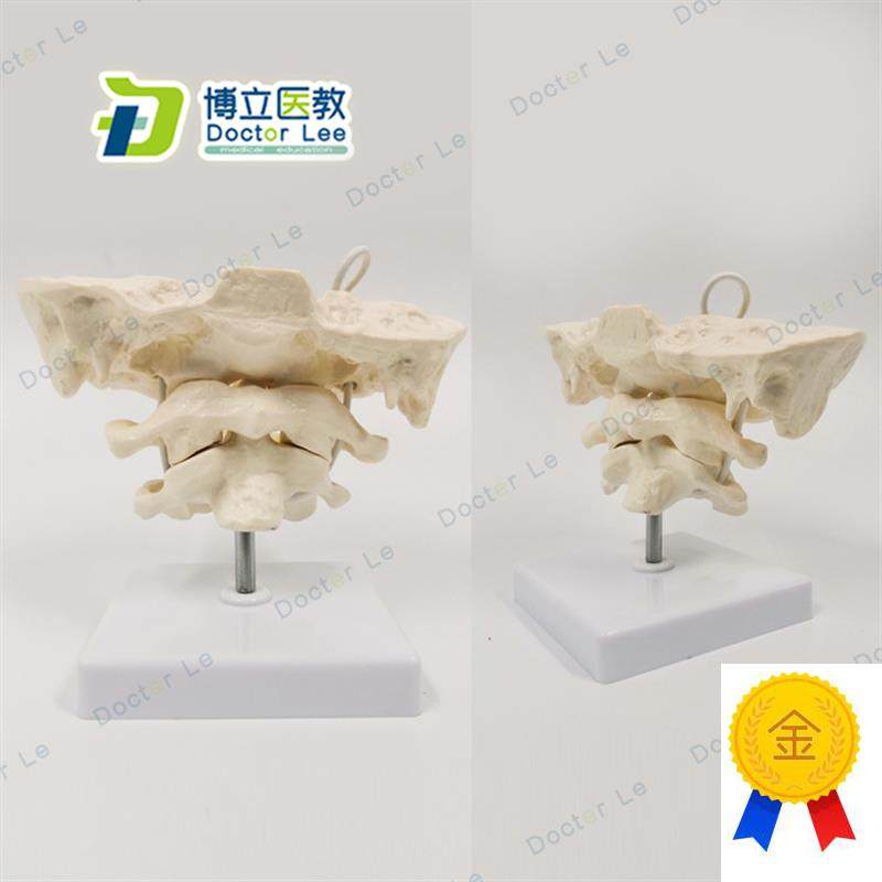 后枕骨颈椎带颈动脉椎间盘与神经教K学模型腰椎骨骼架模型