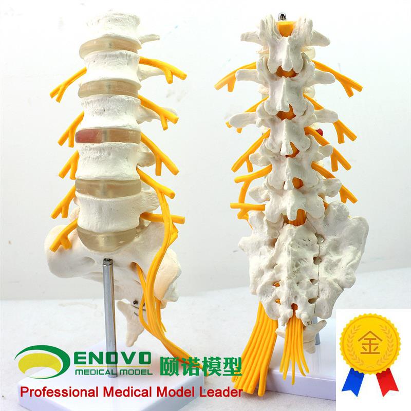 ENOVO颐诺医学人体五节腰椎模型马尾神经坐骨神T经模型脊椎骨科模