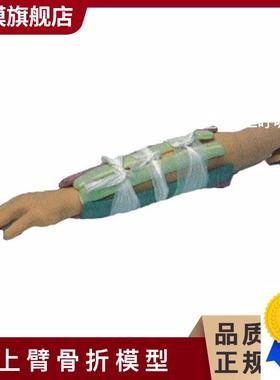 沪模HM/H340上臂骨l折模型可用于手法复位及小夹板固定训练上臂骨