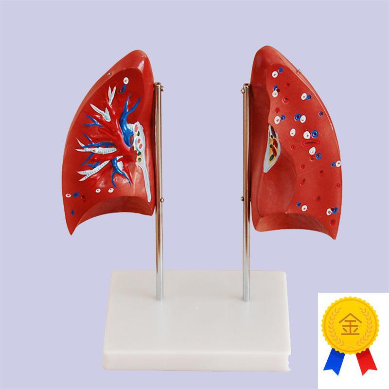 肺解剖模型