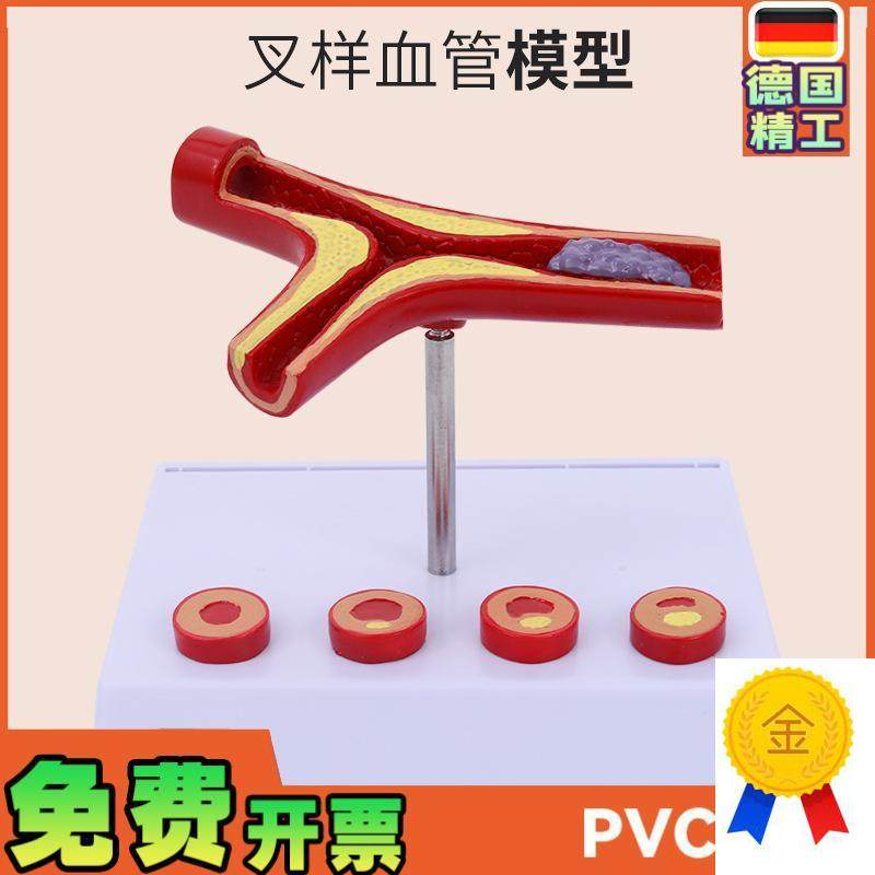 人体血管解剖模型血管模型动脉B(硬)化展示各阶段年龄层血管