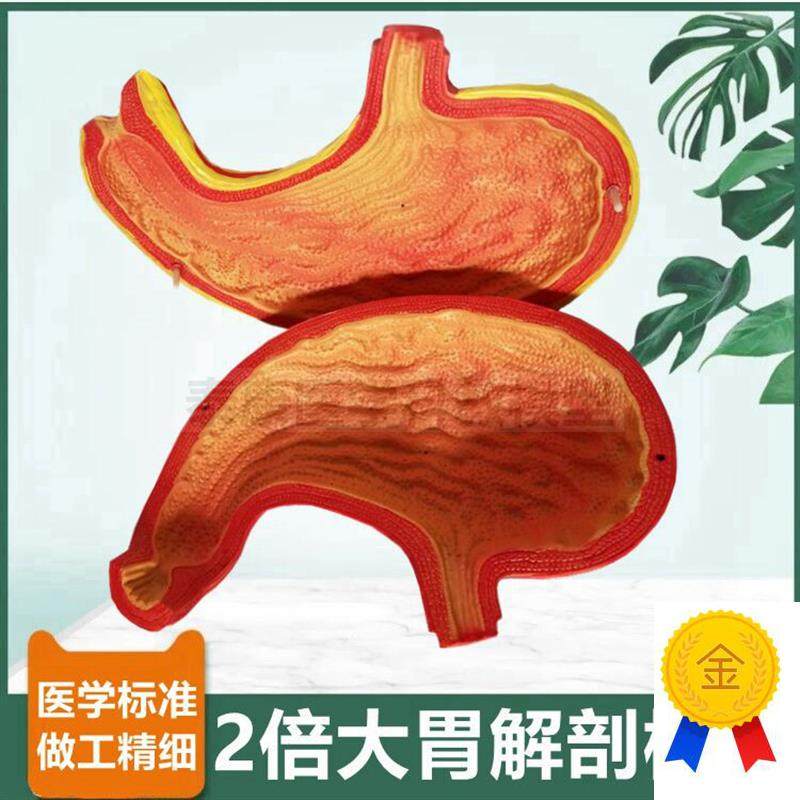 人体胃解剖模型2倍大拆卸胃壁粘膜消化器官病理临床X教学医患礼品