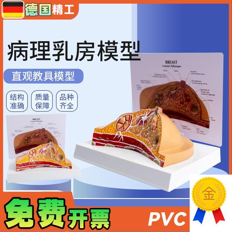 德国】病理乳f房模型妇科乳房解剖模型乳房病理解剖乳房结构模型