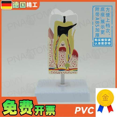 德国】人体牙齿模型蛀牙龋齿解剖口腔科牙科教学U牙神经医患沟通
