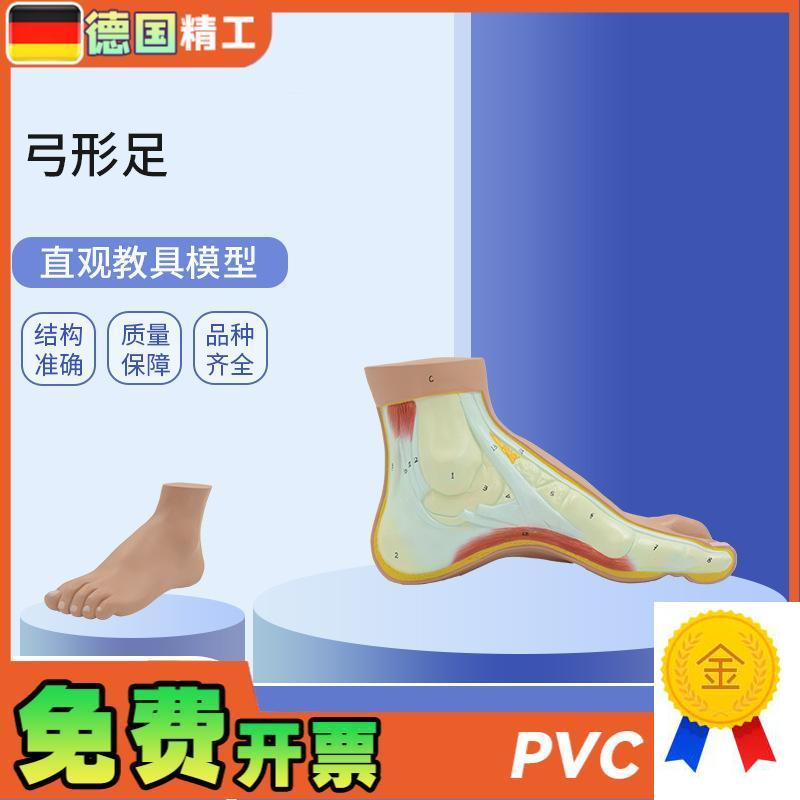 德国】PNT-0727弓形足模型B足部病理模型人体足部解剖模型脚关