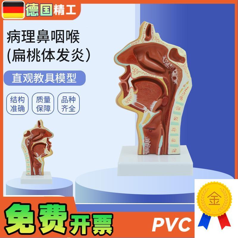 德国】PNT-0736人r体鼻腔咽喉解剖教学模型病理鼻咽喉(扁桃体发
