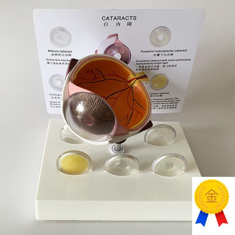 白内障眼睛模型晶k片虹膜器官解剖光学教仪医用医学教学教具包邮