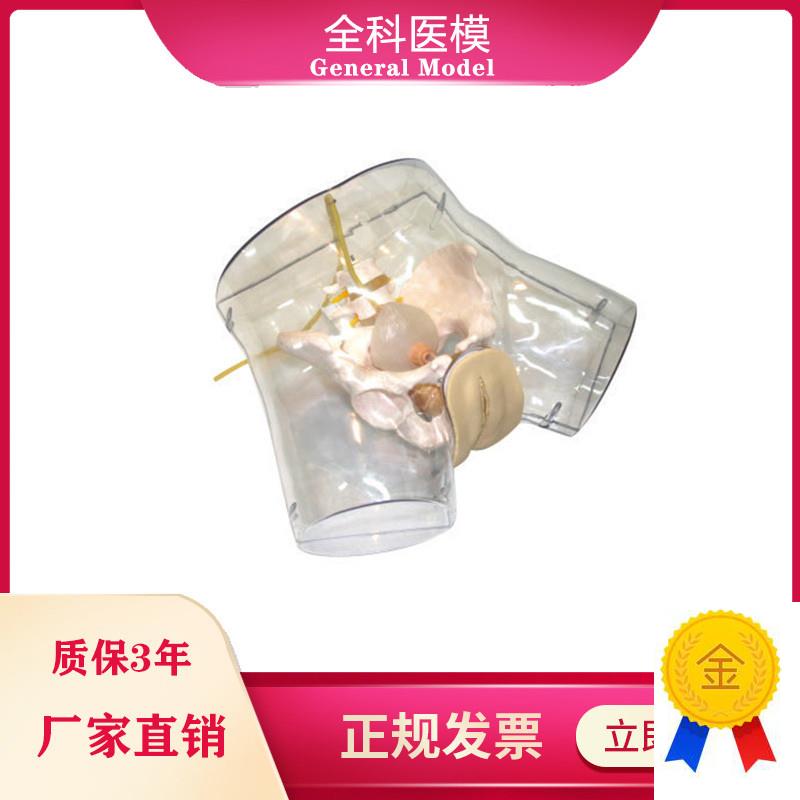 透明刮宫模型护理导尿m人工流产妇科阴部内部解剖观察模型GM/FT32