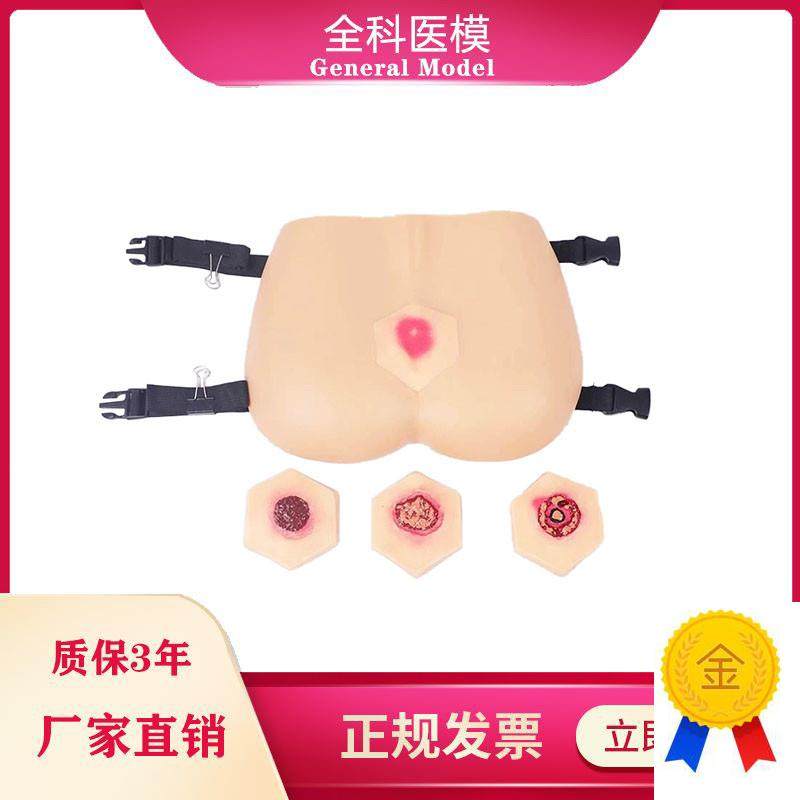 阶段褥疮护理模型压m疮培训教具臀部模型医学教学用模型GM-RC-3