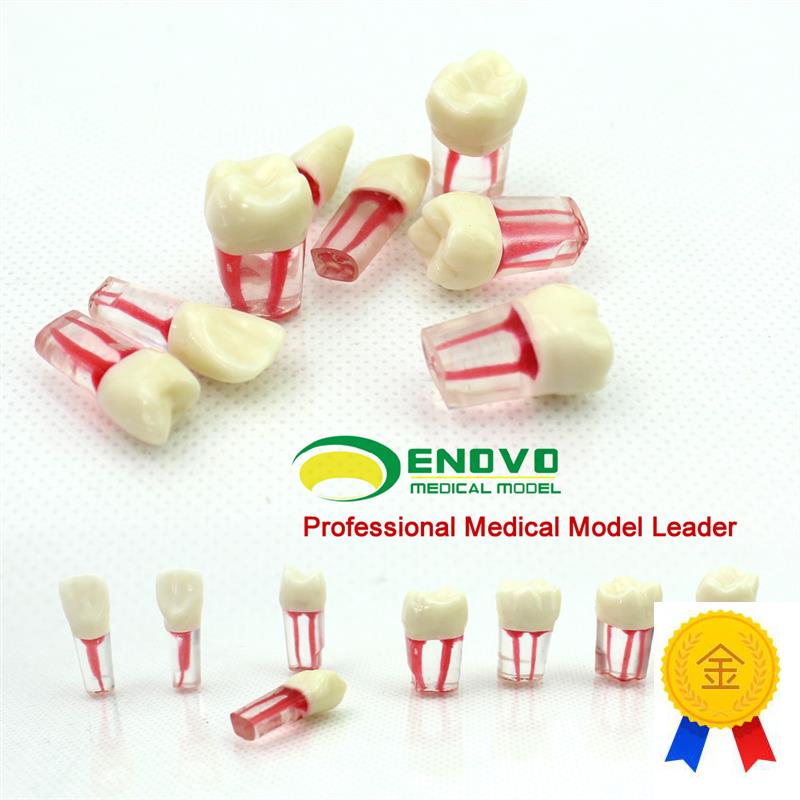 ENOVO颐诺口腔科p根管离体牙模型牙体牙髓学根管充填制备8个牙位