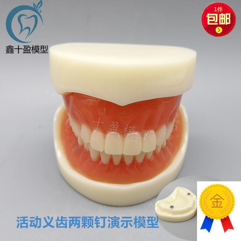 牙科模型活动义齿牙模讲解模w型全口义齿两颗钉教学模型T21包邮