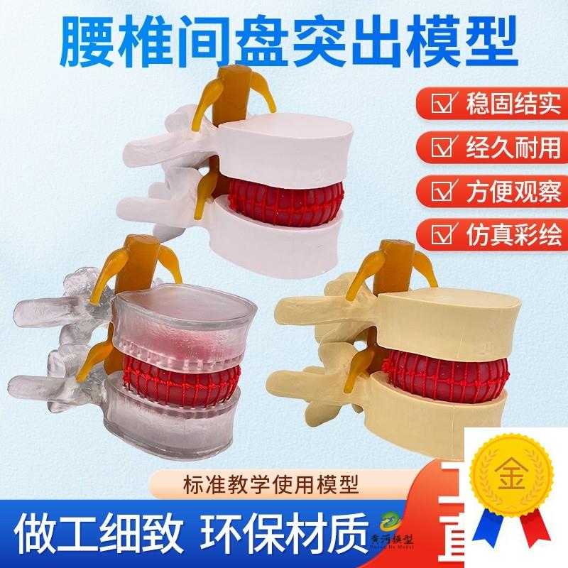 教学仿真人体腰椎间盘演示突出模型脊柱H测压演示脊椎压力病变脊