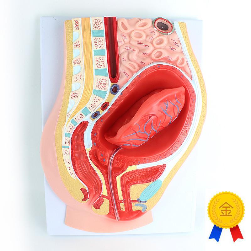 ENOVO颐诺胎i盘剥离模型模型组织胚胎胎儿妇产科教学placenta培训