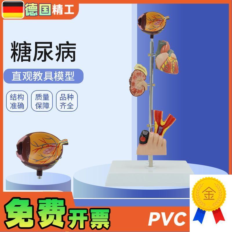 德国】人体医学j糖尿并发症眼睛心脏肾脏血管足内外科康复病理演
