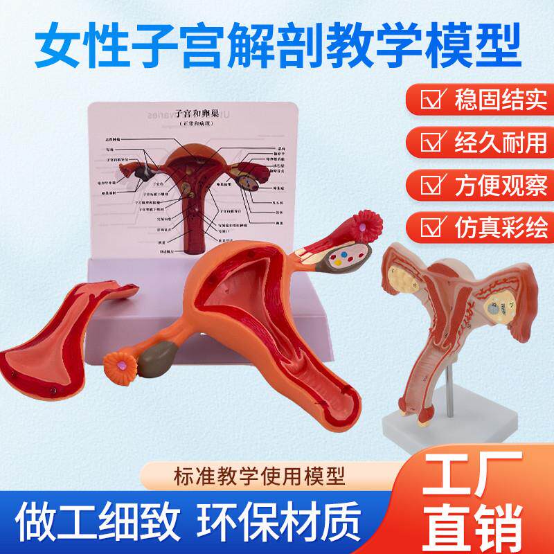 人体女性a生殖子宫解剖病理模型阴道卵巢教学模型妇科生殖科教具