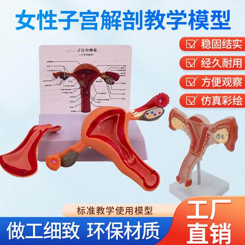 人体女性a生殖子宫解剖病理模型阴道卵巢教学模型妇科生殖科教具