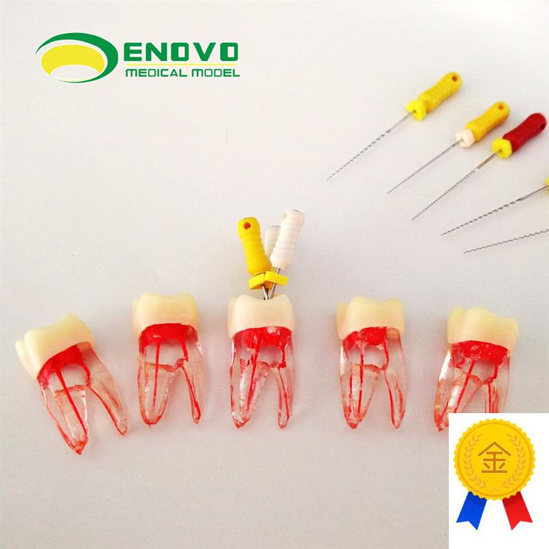 ENOVO正品根管仿真离体RCT根管教学练习牙体U牙髓根管器械操作