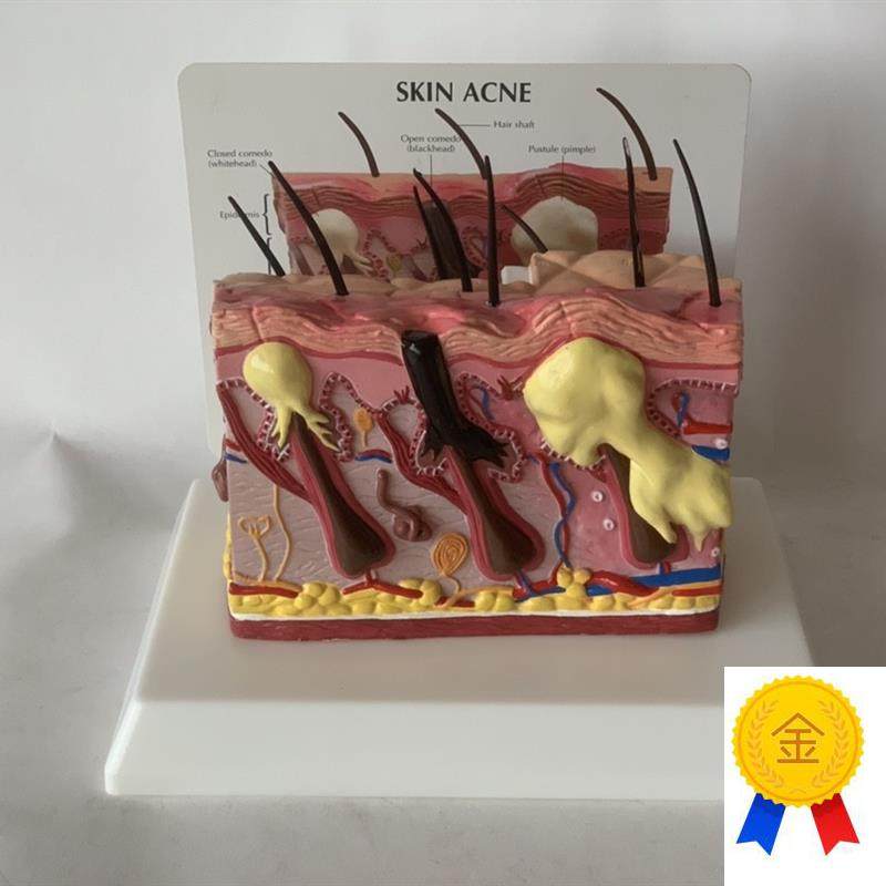 人体皮肤放大皮肤痤疮毛发生长A头发健康皮肤脱发毛囊毛细血管黑