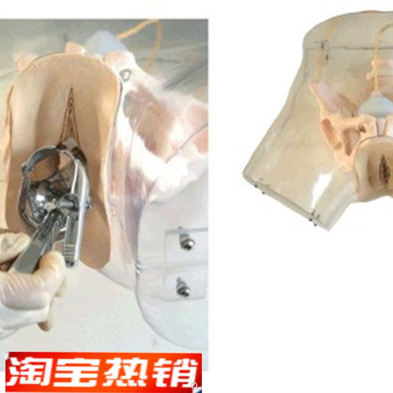 高级透明刮宫模型