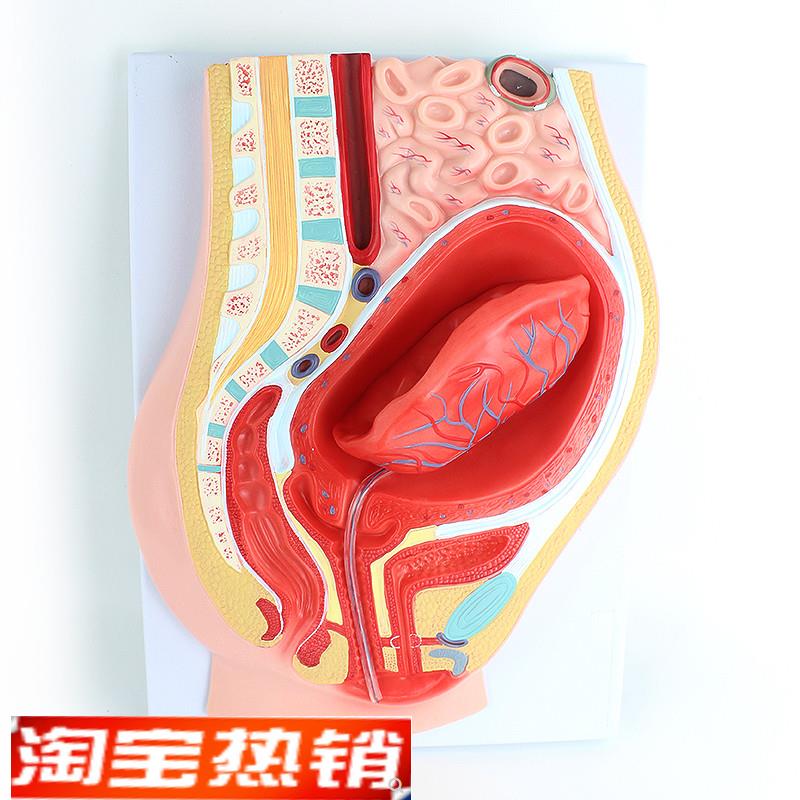 ENOVO颐诺 胎盘剥离模型模型组织胚胎胎儿妇产科教学placenta培训