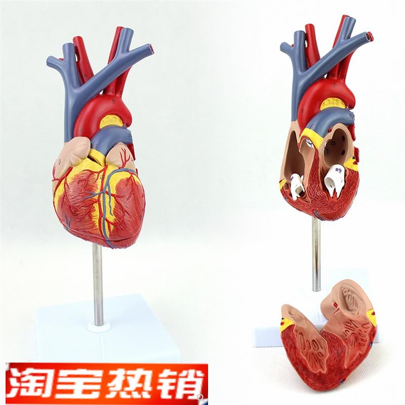 ENOVO颐诺人体心脏模型医学心血管内科心脏介入解剖教学冠状动脉