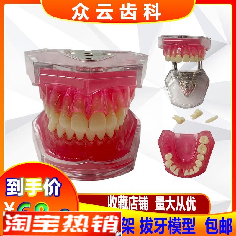 专业牙齿拔牙练习模型模具全口可拆卸牙齿软牙龈28颗单色恒牙包邮