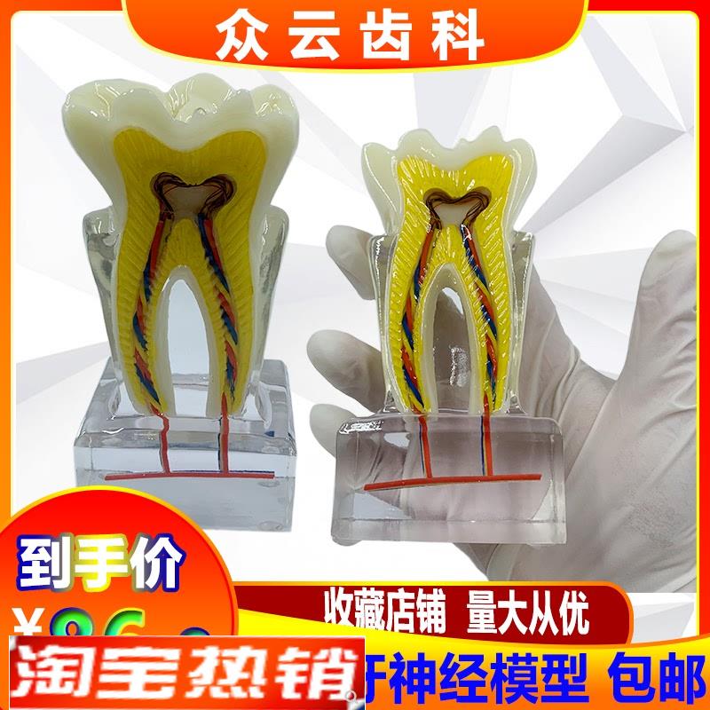 口腔牙科教学教具6倍牙神经模型水晶牙齿结构造解剖 医患沟通包邮