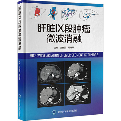 肝脏Ⅸ段肿瘤微波消融 王在国,周建平 编 影像医学生活 新华书店正版图书籍 北京大学医学出版社