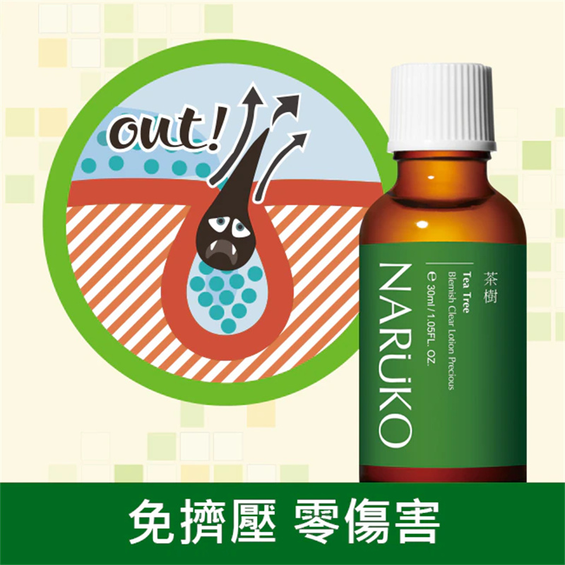 牛尔naruko茶树抗痘粉刺露