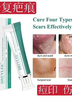 草本手术伤疤增生修护膏去凹凸疙瘩疤痕淡化黑色素痘印痘坑拍2发3