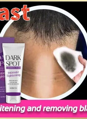 Nicotinamide Brightening Cream For Dark Skin Effective