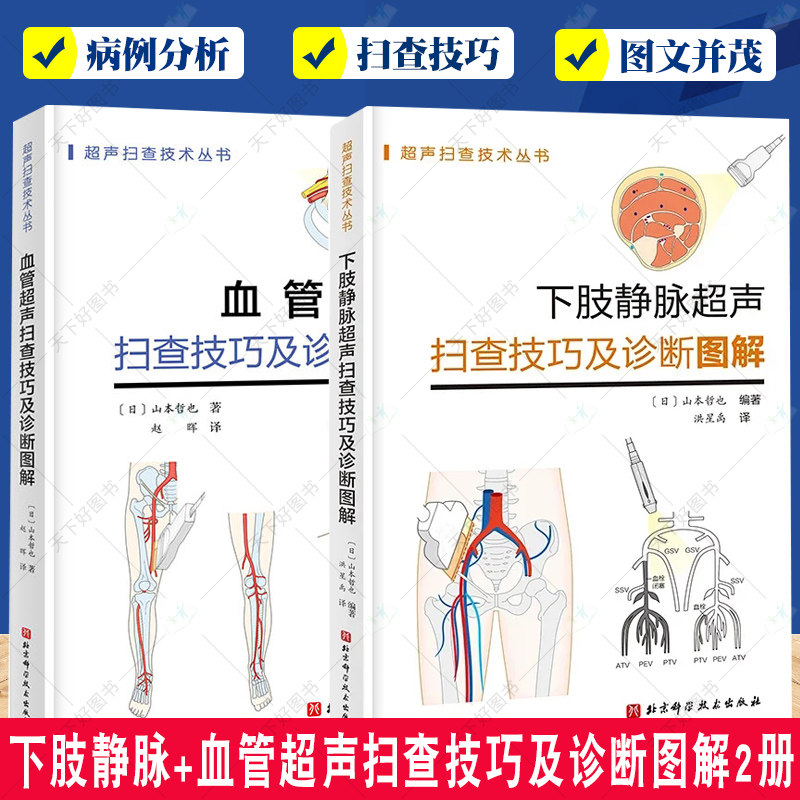 正版包邮 下肢静脉超声扫查技巧及诊断图解+血管超声扫查技巧及诊断图解2册 超声扫查技术丛书 血管超声进阶诀窍 主动脉超声