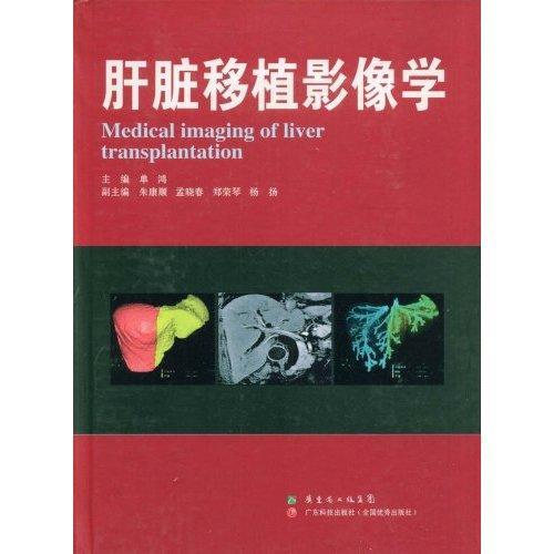 正版包邮 肝脏移植影像学 单鸿 青年肝移植影象诊断医药卫生书籍 医学临床书籍 9787535945549 广东科学技术出版社