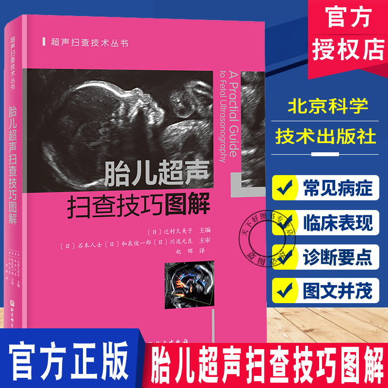 胎儿超声扫查技巧图解 超声扫查技术丛书 一本书彻底搞懂胎儿心超扫查切面正常胎儿神经系统发育超声解剖图谱 北京科学技术出版社