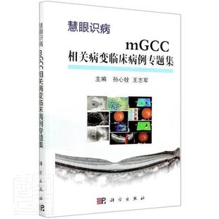 mGCC相关病变临床病例专题集(慧眼识病)(精) 孙心铨 黄斑病变病案专题汇 医药卫生书籍
