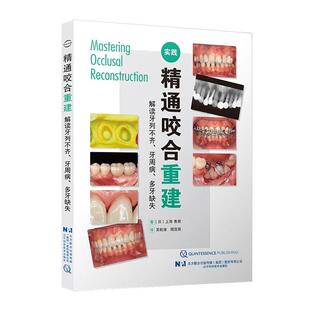 精通咬合重建——解读牙列不齐、牙周病、多牙缺失 上田秀朗   医药卫生书籍