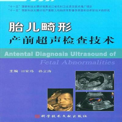 正版书籍 胎儿畸形产前超声检查技术田家玮科学技术文献出版社医药卫生畸胎超声波诊断 人天书店畅销书排行榜