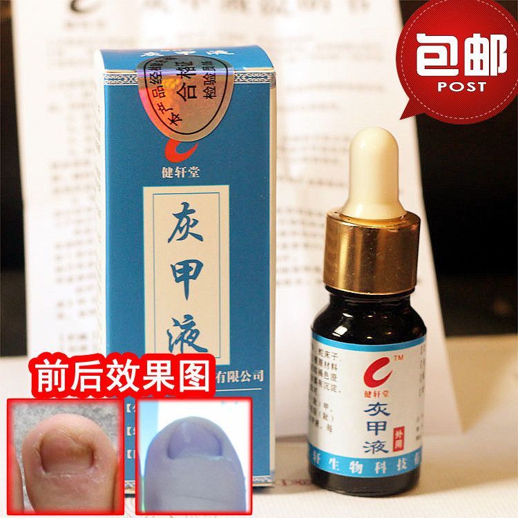 健轩灰甲液去除厚趾滴正品