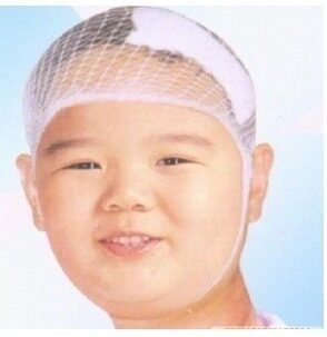 网状弹力帽弹力网帽头部伤口包扎弹性网状绷带网套弹力网状头套